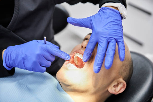 Best Emergency Wisdom Teeth Removal in Tega Cay, SC
